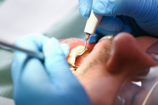 Best Emergency Dentist for Lost Fillings or Crowns in Central, SC