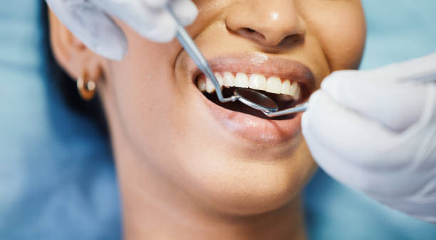 Best Emergency Dentist for Lost Fillings or Crowns in Central, SC